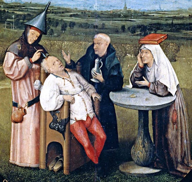 Trepanning - Wikipedia