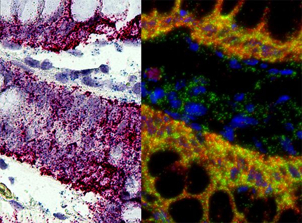 In situ hybridization - Wikipedia