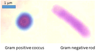 Gram stain - Wikipedia