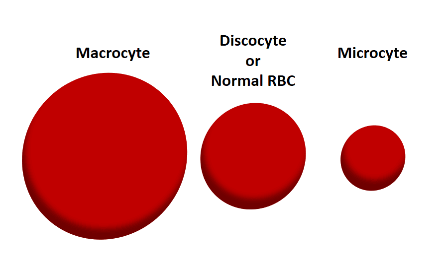 Macrocytosis - Wikipedia