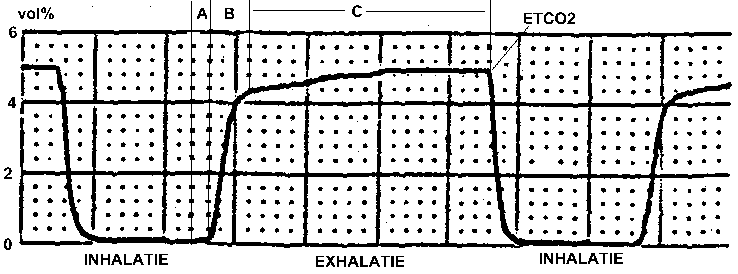 Capnography - Wikipedia