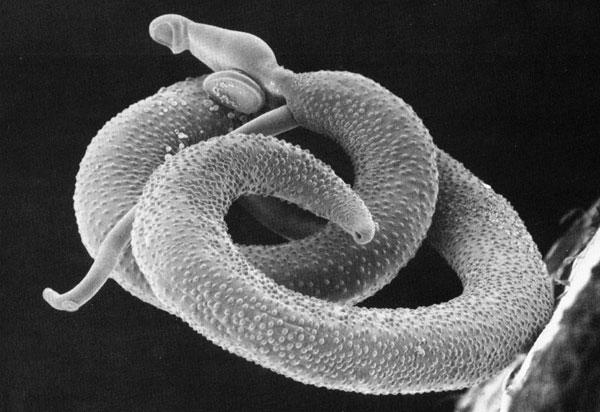 Schistosoma mansoni - Wikipedia