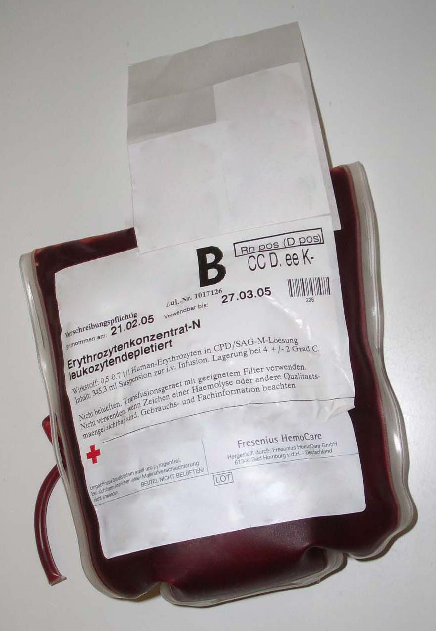 Blood transfusion - Wikipedia