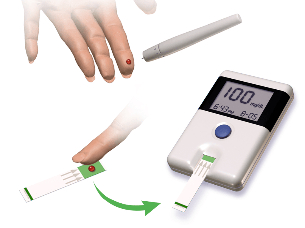 Blood glucose monitoring - Wikipedia