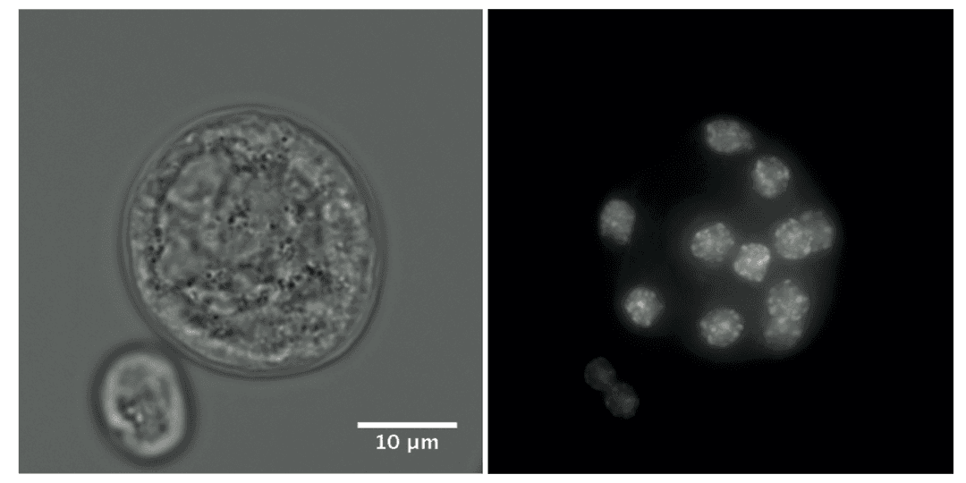 Coenocyte - Wikipedia