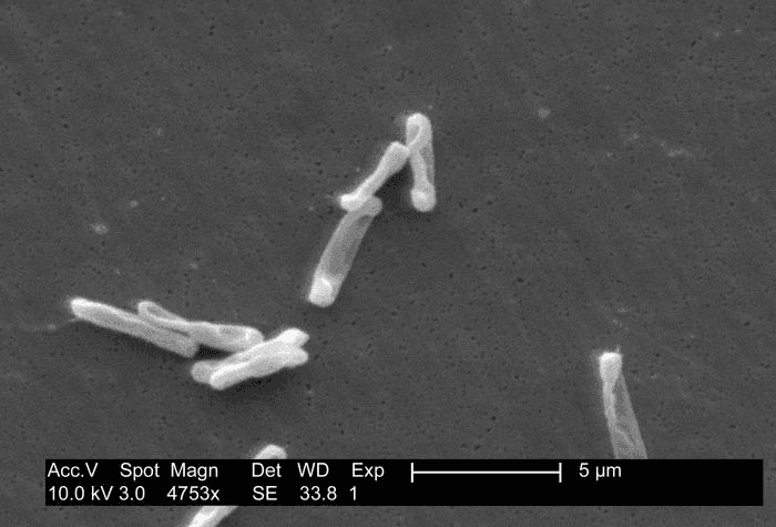 Clostridioides difficile — Wikipédia