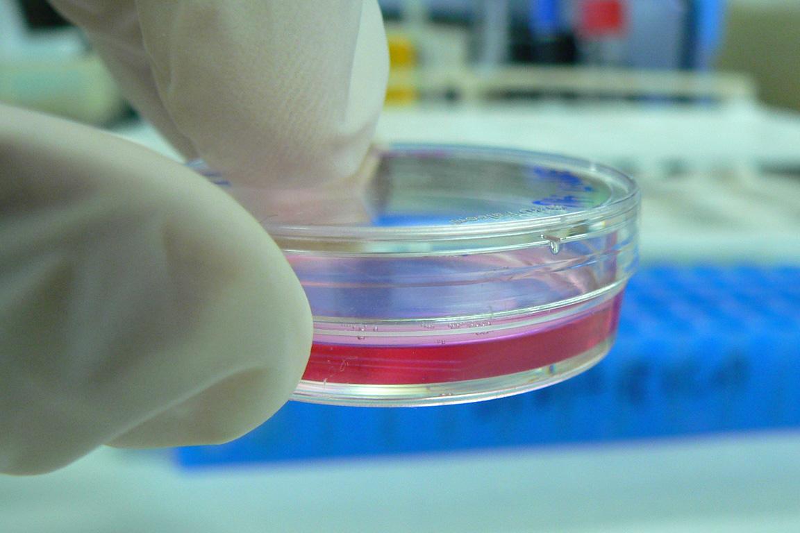 Cell culture - Wikipedia