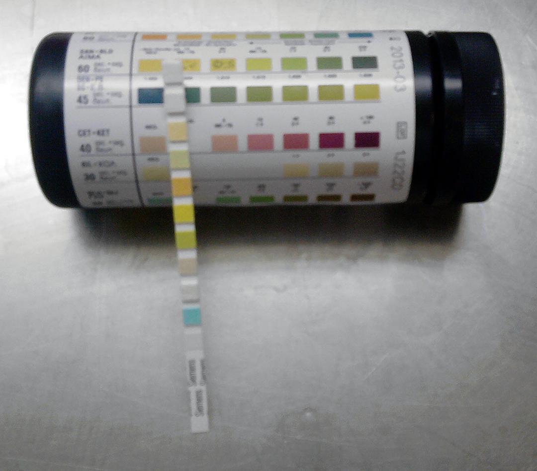 Urine test strip - Wikipedia