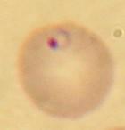 Plasmodium falciparum — Wikipédia