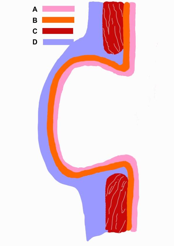 Diverticulum - Wikipedia