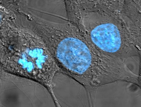 Cell nucleus - Wikipedia