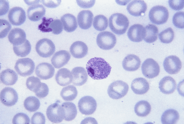 Plasmodium vivax - Wikipedia