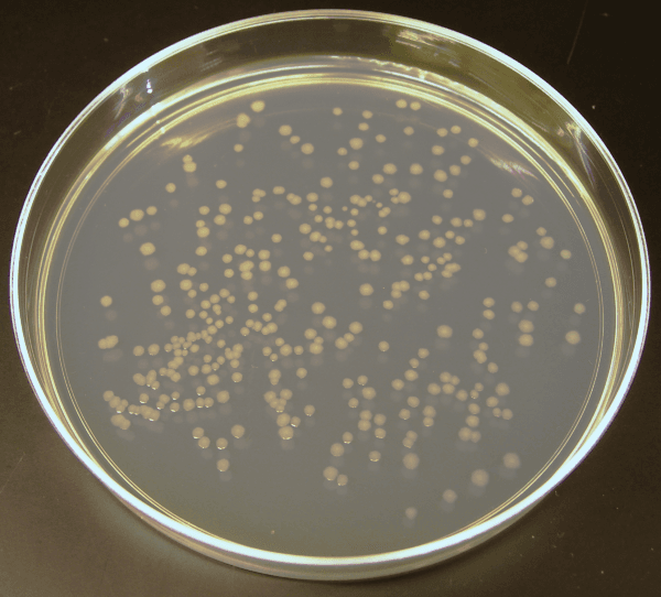 Agar plate - Wikipedia