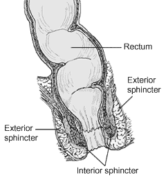 Anorectal manometry - Wikipedia