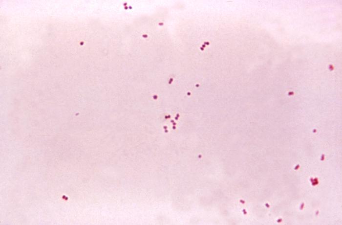 Neisseria meningitidis — Wikipédia