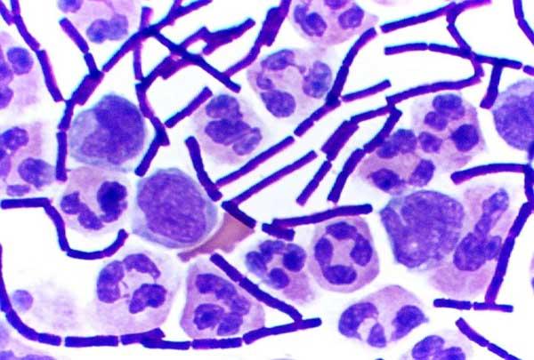 Gram-positive bacteria - Wikipedia