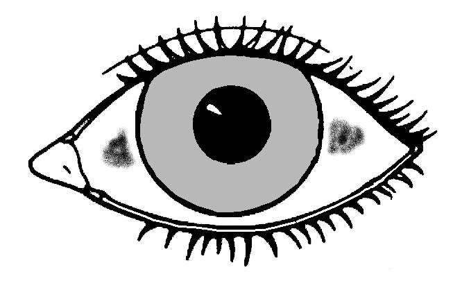 Xerophthalmia - Wikipedia