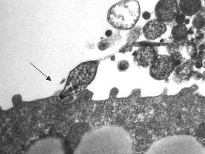 Mycoplasma pneumoniae — Wikipédia