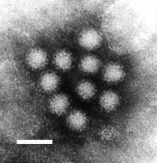 Norovirus - Wikipedia