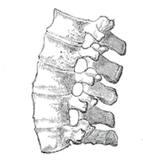 Spondylarthrite ankylosante — Wikipédia