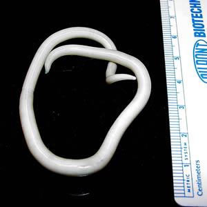 Ascaris lumbricoides - Wikipedia