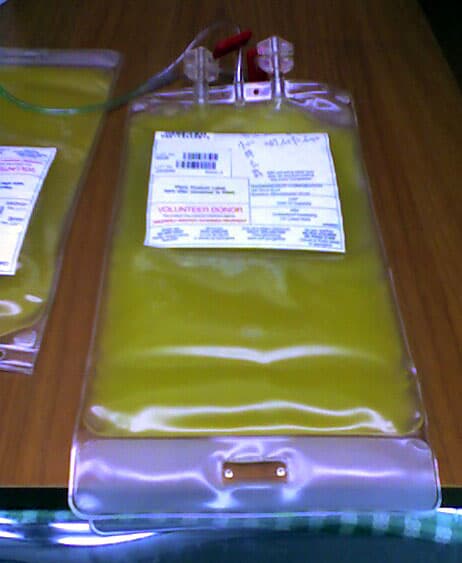 Platelet transfusion - Wikipedia