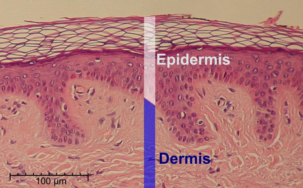 Epidermis - Wikipedia