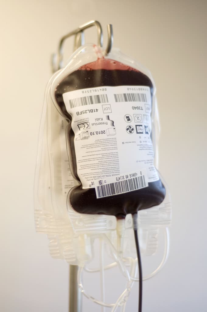 Transfusion sanguine — Wikipédia