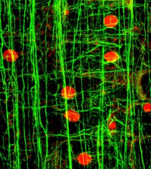 Protein filament - Wikipedia