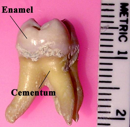 Tooth enamel - Wikipedia