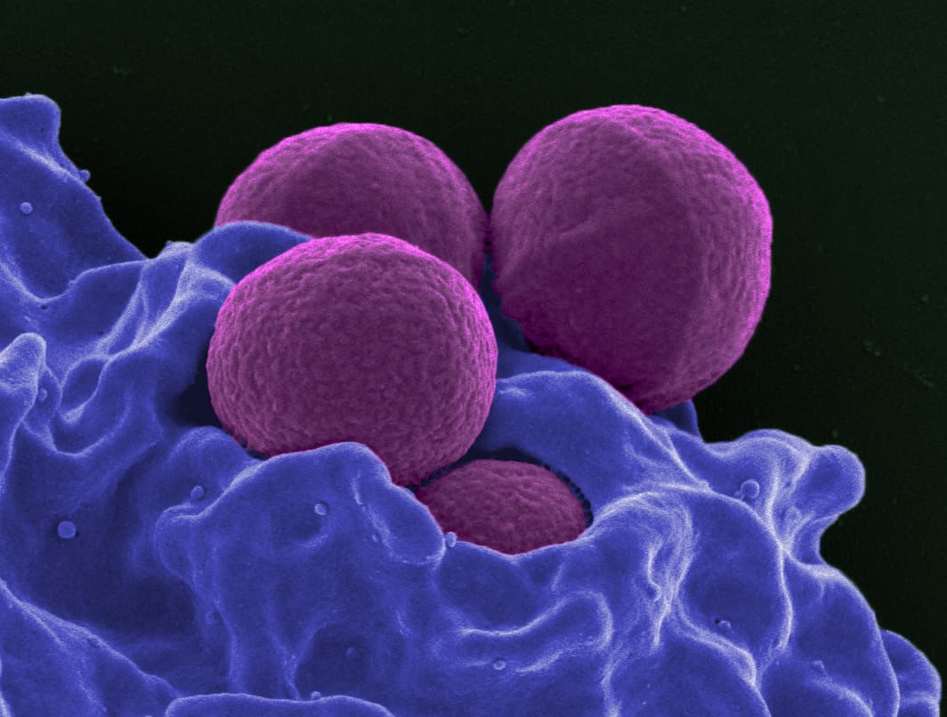 Broad-spectrum antibiotic - Wikipedia