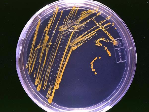 Microbiology - Wikipedia