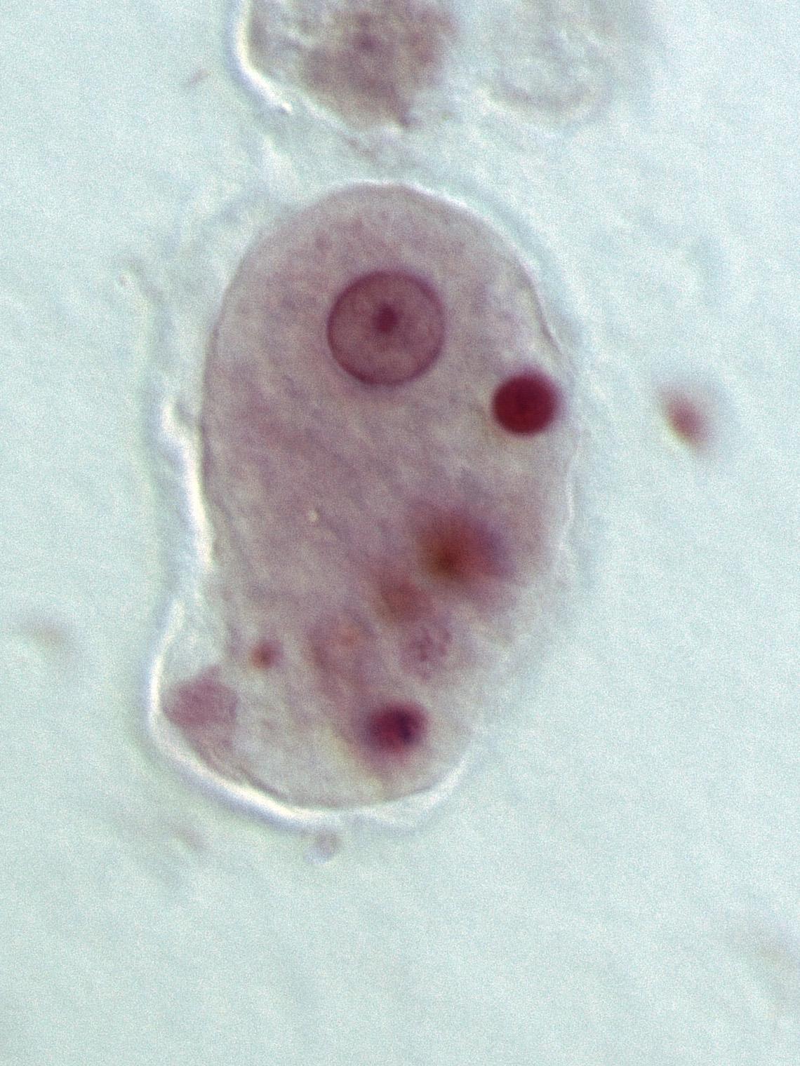 Entamoeba - Wikipedia