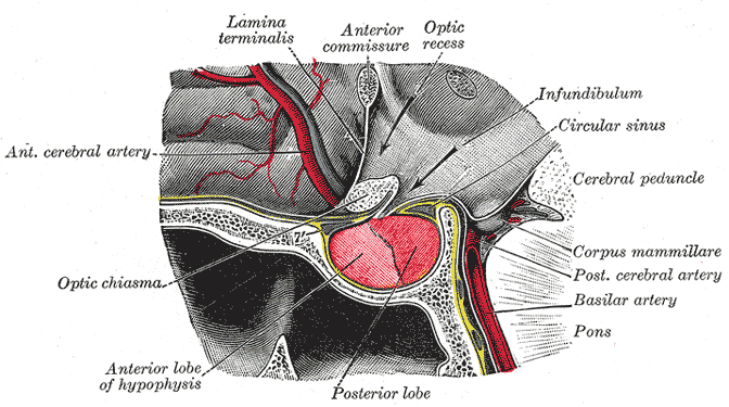 Hypopituitarism - Wikipedia