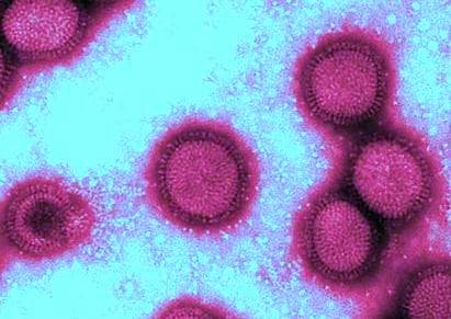 Virus de la grippe A (H1N1) — Wikipédia