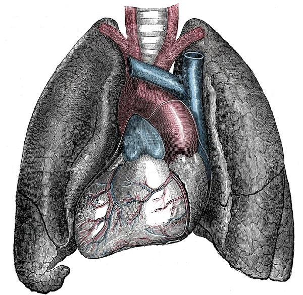 Situs inversus — Wikipédia