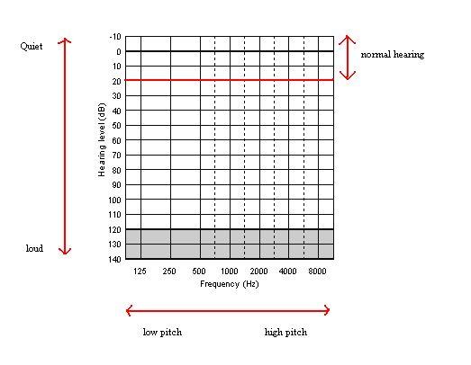 Audiogram - Wikipedia