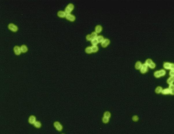 Streptococcus pneumoniae - Wikipedia