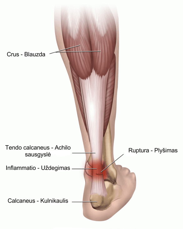 Tendon — Wikipédia