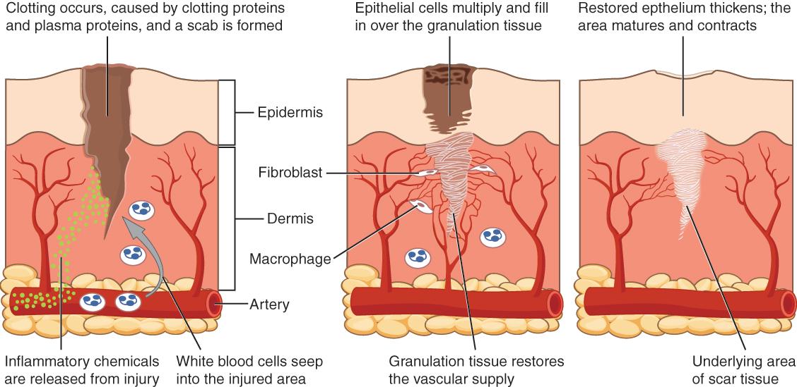 Healing - Wikipedia