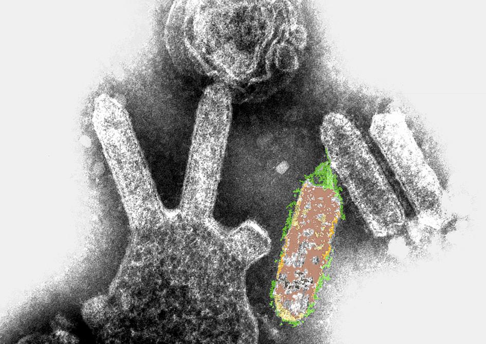 Lyssavirus - Wikipedia