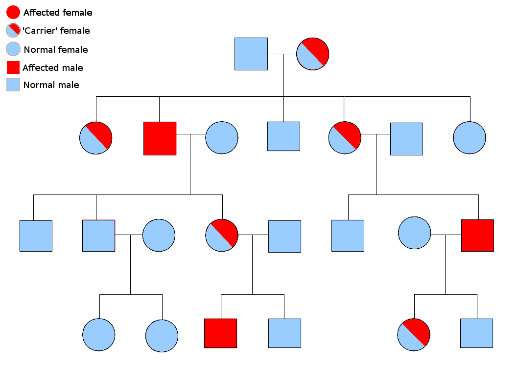 Choroideremia - Wikipedia