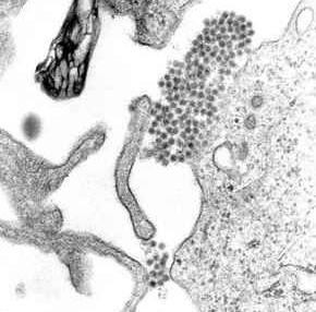 Dengue virus - Wikipedia