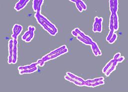 DNA repair - Wikipedia