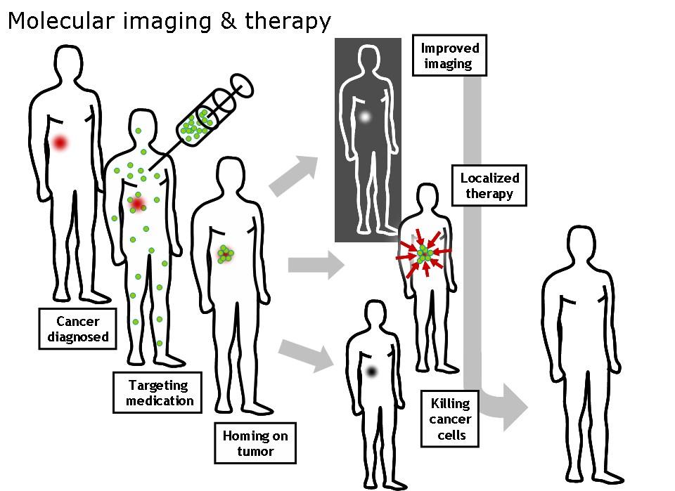 Molecular imaging - Wikipedia