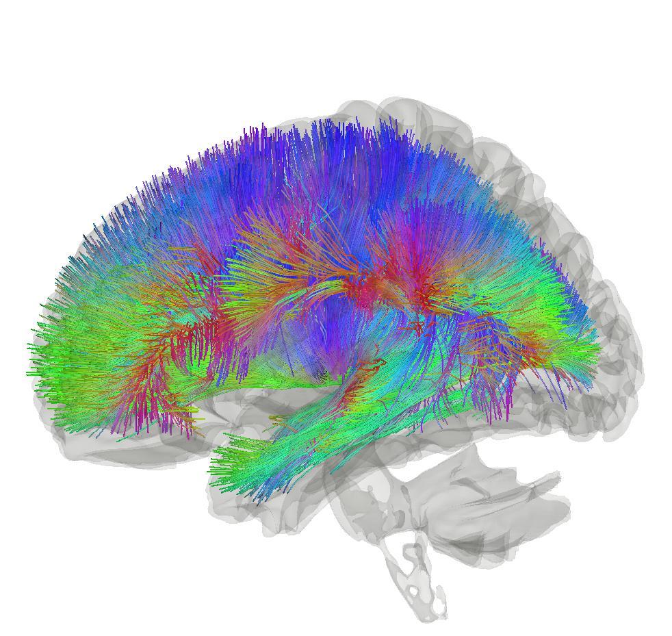 Thalamocortical radiations - Wikipedia