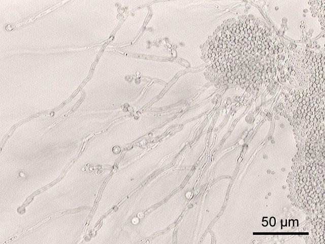 Candida albicans — Wikipédia