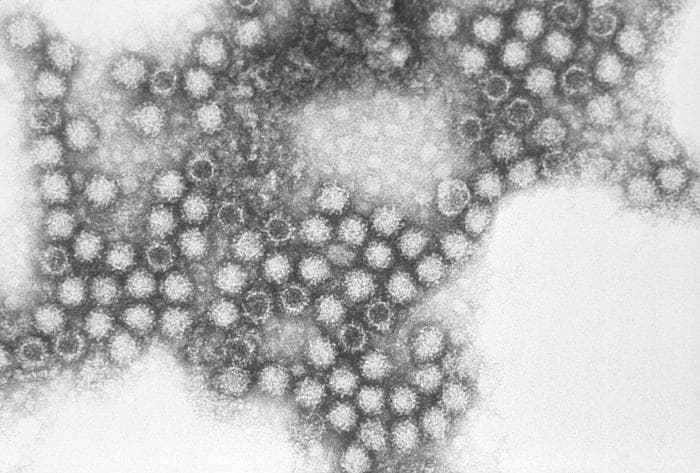 Calicivirus félin — Wikipédia