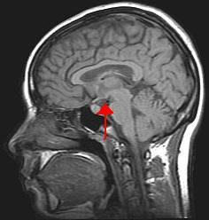 Hypothalamus - Wikipedia