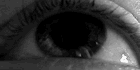 Nystagmus - Wikipedia